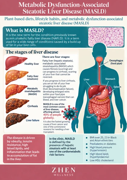 Original illustrated Zhen Wellness picture sheet about Fatty liver disease: understanding MASLD and fibrosis